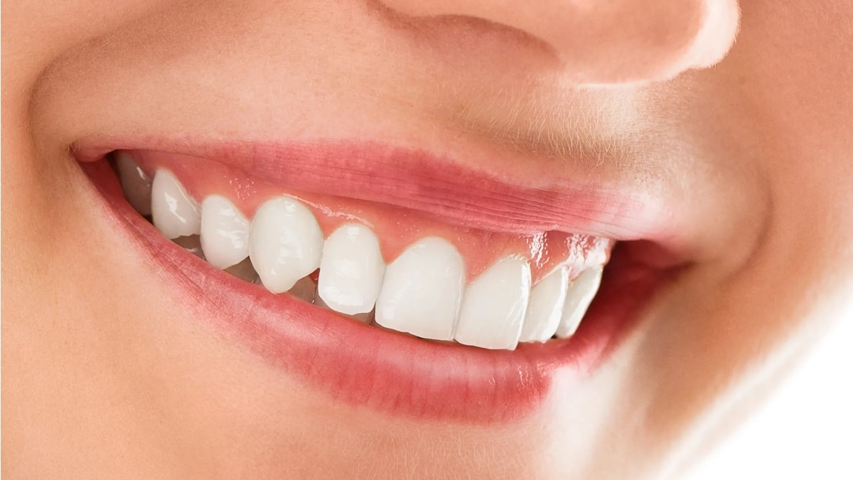 foto van lachende vrouw met witte tanden